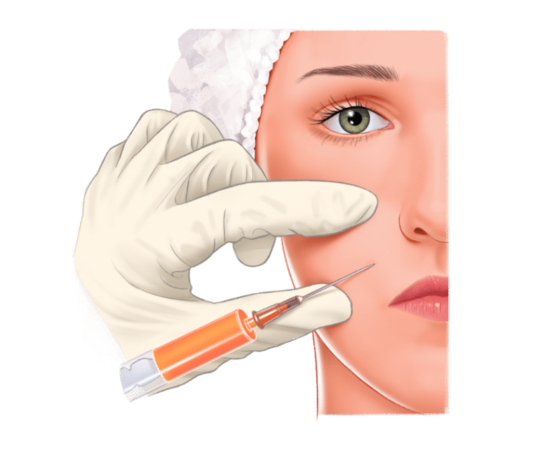 Lipofilling o injerto graso | Clínica Fossati